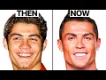 Cristiano Ronaldo NEW FACE Plastic Surgery Analysis