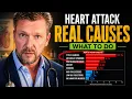 Real Heart Attack Causes Revealed And What You Can Do