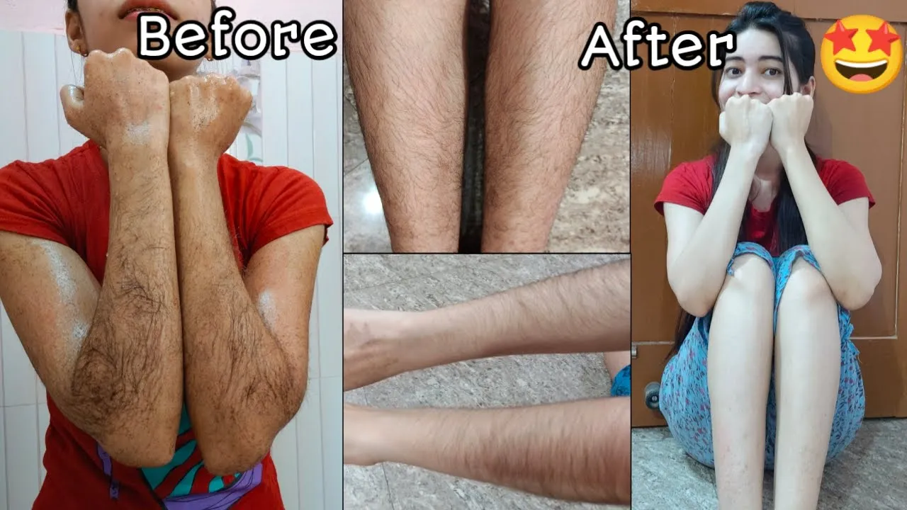 L'Oreal Paris Revitalift 1,5% Hyaluronic Acid Serum on Acne Prone Skin Review | Kiara Leswara