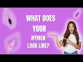 What Does Your Hymen Look Like