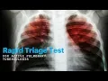 Rapid Triage Test for Active Pulmonary Tuberculosis