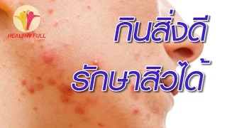  ทำไมการกินอาหารที่มีน้ำตาลและแป้งขัดขาวถึงทำให้สิวแย่ลง 