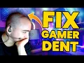 GAMER DENT Not with THIS