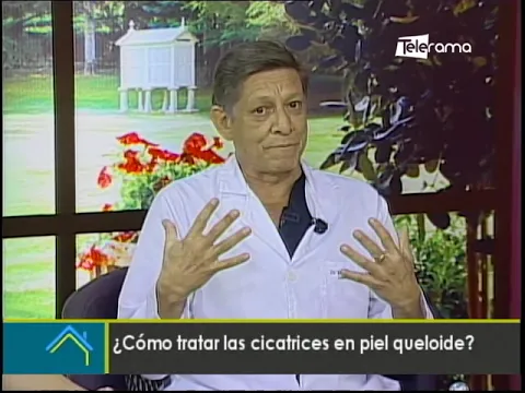 ¿Cómo tratar las cicatrices en piel queloide?