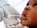 How To Collect Mouth Swabs for DNA Testing