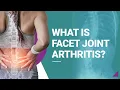 What is Facet Joint Arthritis