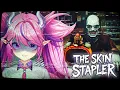 The Skin Stapler Wants My Skin
