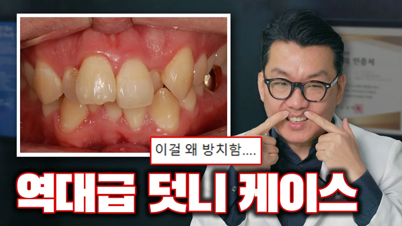 역대급 교정, 이 정도 상태도 예뻐질 수 있습니다