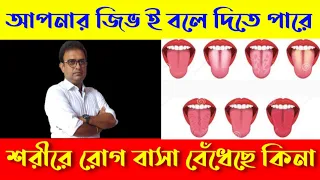 what tongue says about your health