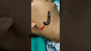 اذا علقت بك هذه الدودة افعل هذا الشيء فورا   دندنها