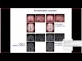 SPM12 Kyiv 2015 part 6 - normalisation