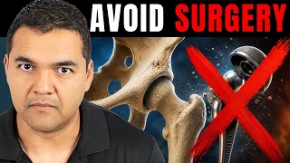 7 Treatments That Can Help You Avoid a Hip Replacement
