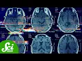 Download Lagu Perimenopause Is Real And It Changes Your Brain