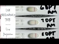 IVF Round LIVE PREGNANCY TESTS 7-8 DP5DT TWW Symptoms Becoming a Single Mom by Choice