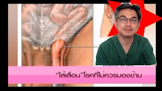 ไส้เลื่อนคืออะไร และเกิดขึ้นได้ที่บริเวณใดบ้างของร่างกาย