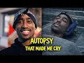 The Autopsy of Tupac Shakur The Medical Truth Behind the Myth