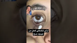 الكحل سبب مشاكل عينك  دندنها