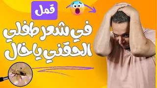 عيب اوى طفلك يكون عنده حشرات شعر وينزل المدرسه من غير ما تعالجيه 