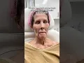 Watch Her Spark Come Back After Having a Full Facial Rejuvenation