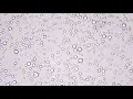Brownian Motion
