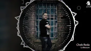 CHEB REDA LA BLESSURE شاب رضا الجرح 