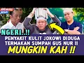 Download Lagu NGERI !! PENYAKIT KULIT JOKOWI DI DUGA TERMAKAN SUMPAH GUS NUR