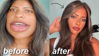 DIY plastic surgery using tiktok hacks that actually work lol