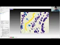 Easy shallow learning with Ilastik
