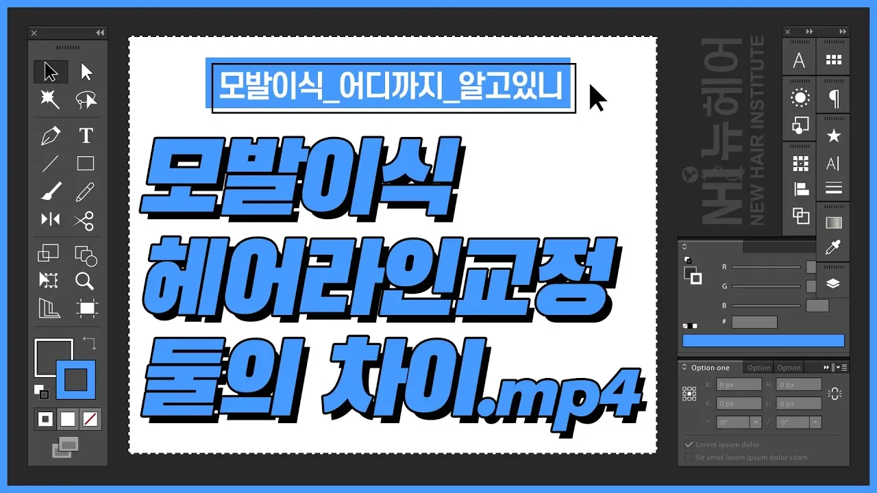 모발이식과 헤어라인교정의 차이점 - 뉴헤어 I 모발이식 I 탈모지식 I