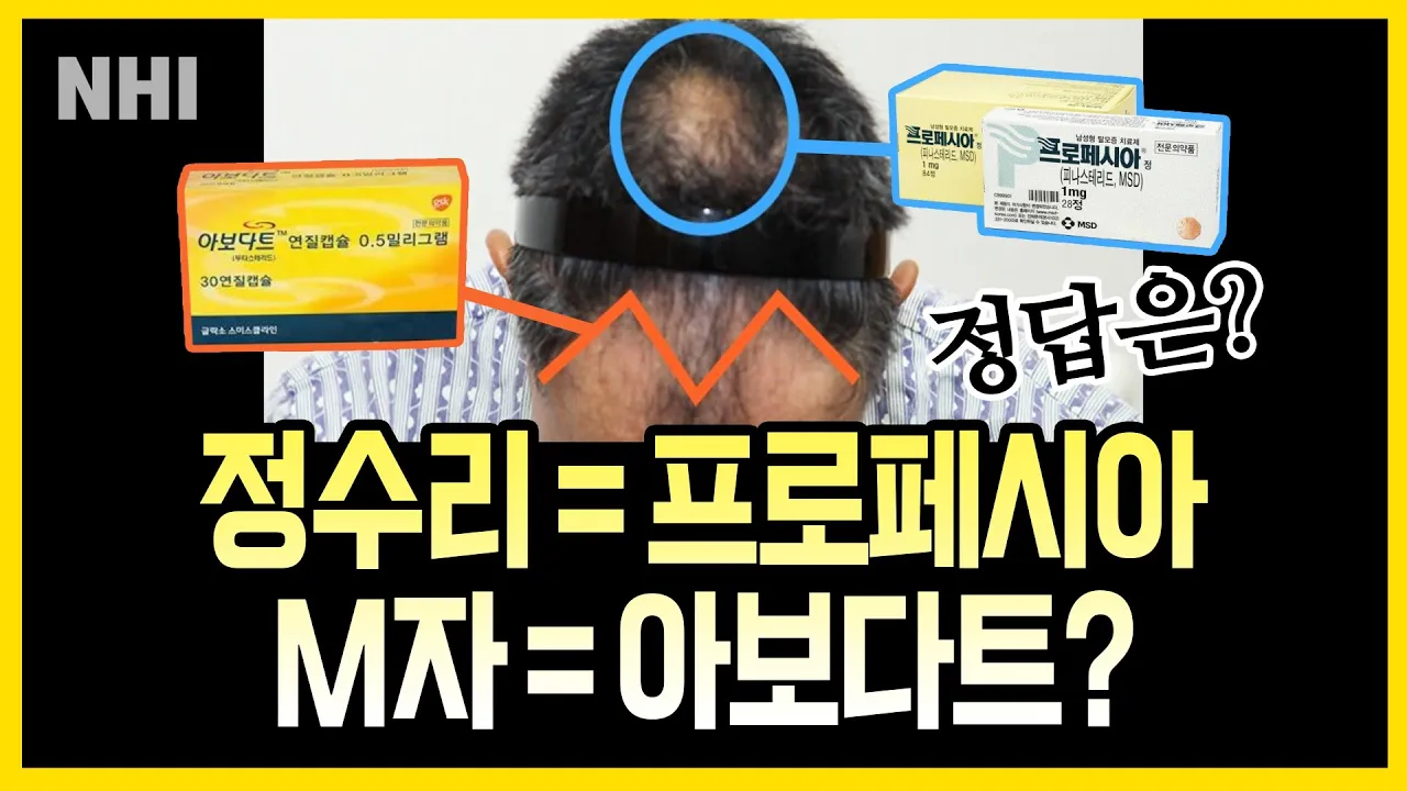 정수리 탈모에는 프로페시아, 엠자 탈모에는 아보다트가 효과 있다?ㅣ뉴헤어