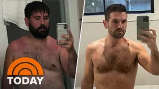 Shay Mooney posts before-and-after pics showing weight loss
