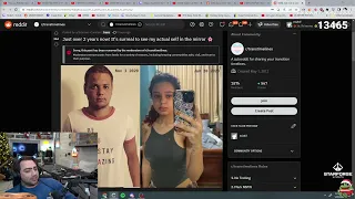 Macaiyla made it to the front page of Trans subreddit after chin surgery