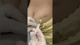 حقنة عضل لطفل عصبى جدا فى البيت Im Injection Hospital Glute Gluteal Musle Im Nurse  حقنة عضل لطفل عصبى جدا فى البيت Im Injection Hospital Glute Gluteal Musle Im Nurse