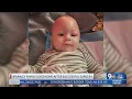 6-month-old baby going home after life-changing surgery