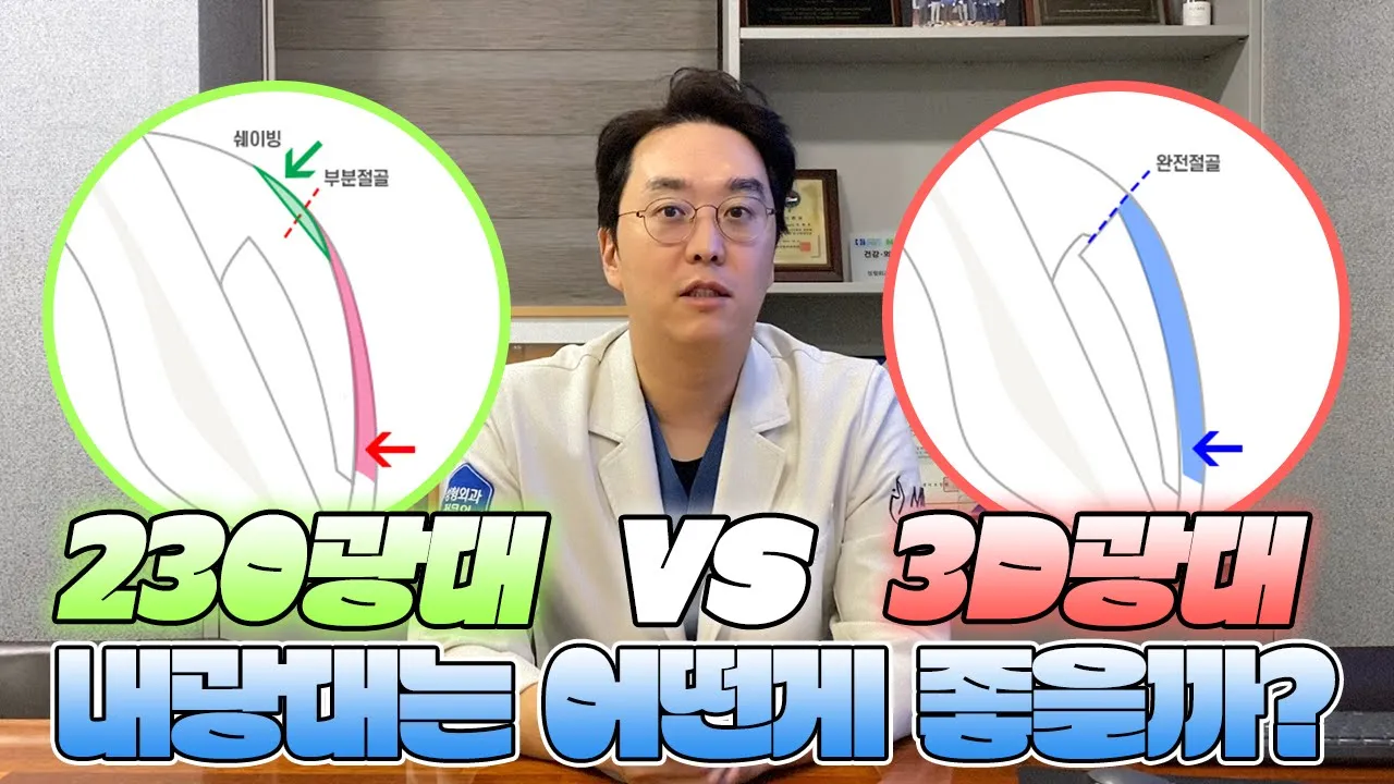 광대축소술 Q&A : 내 광대는 230도광대? 3D광대축소?