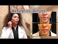 Refyne vs Defyne Restylane s Newest Fillers Compared