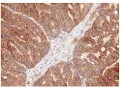 IHC Assay Validation Case Study Webinar - September 2015