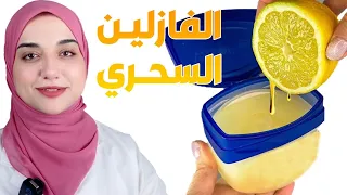                                                                                                دندنها