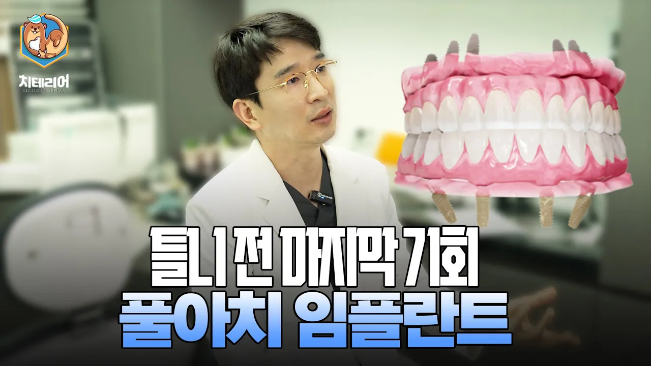 틀니, 전악 임플란트 할 필요가 없습니다.