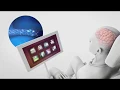 Synchron Stentrode Brain Computer Interface for Paralysis