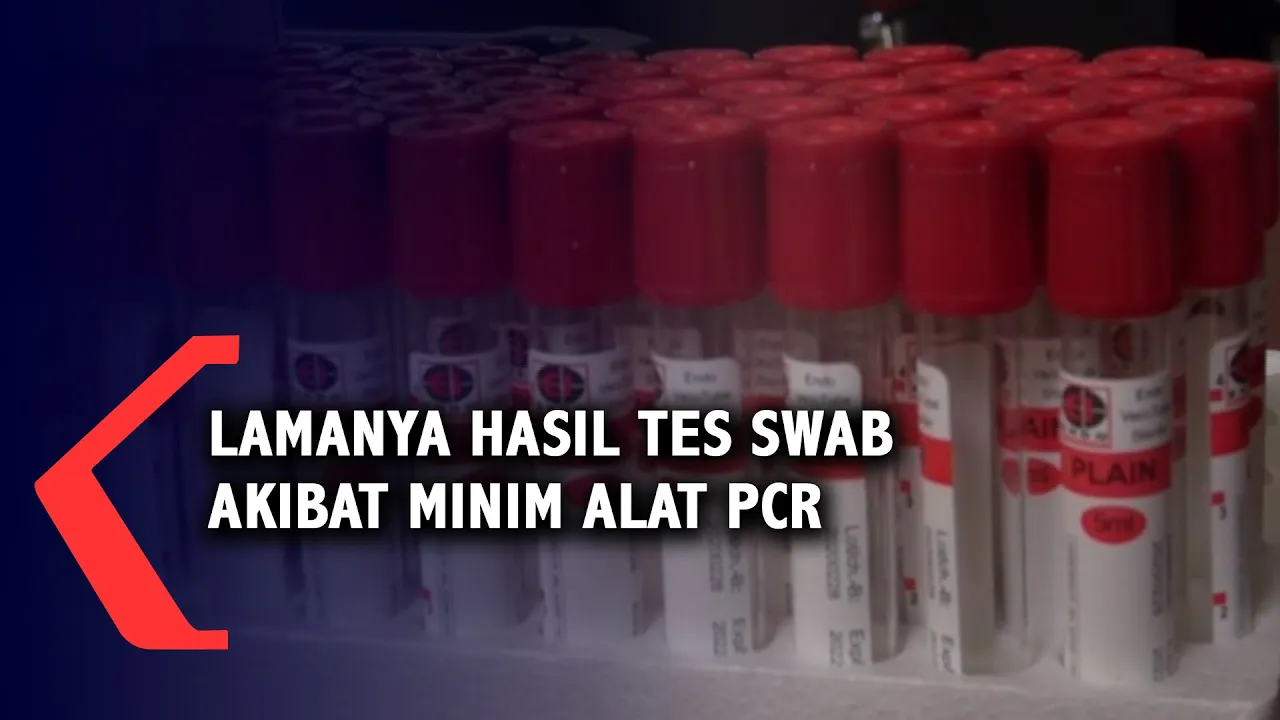 Muncul Foto Hasil Tes SWAB Habib Rizieq Positif Corona, Hoaks? - AIMAN (Bag 3). 