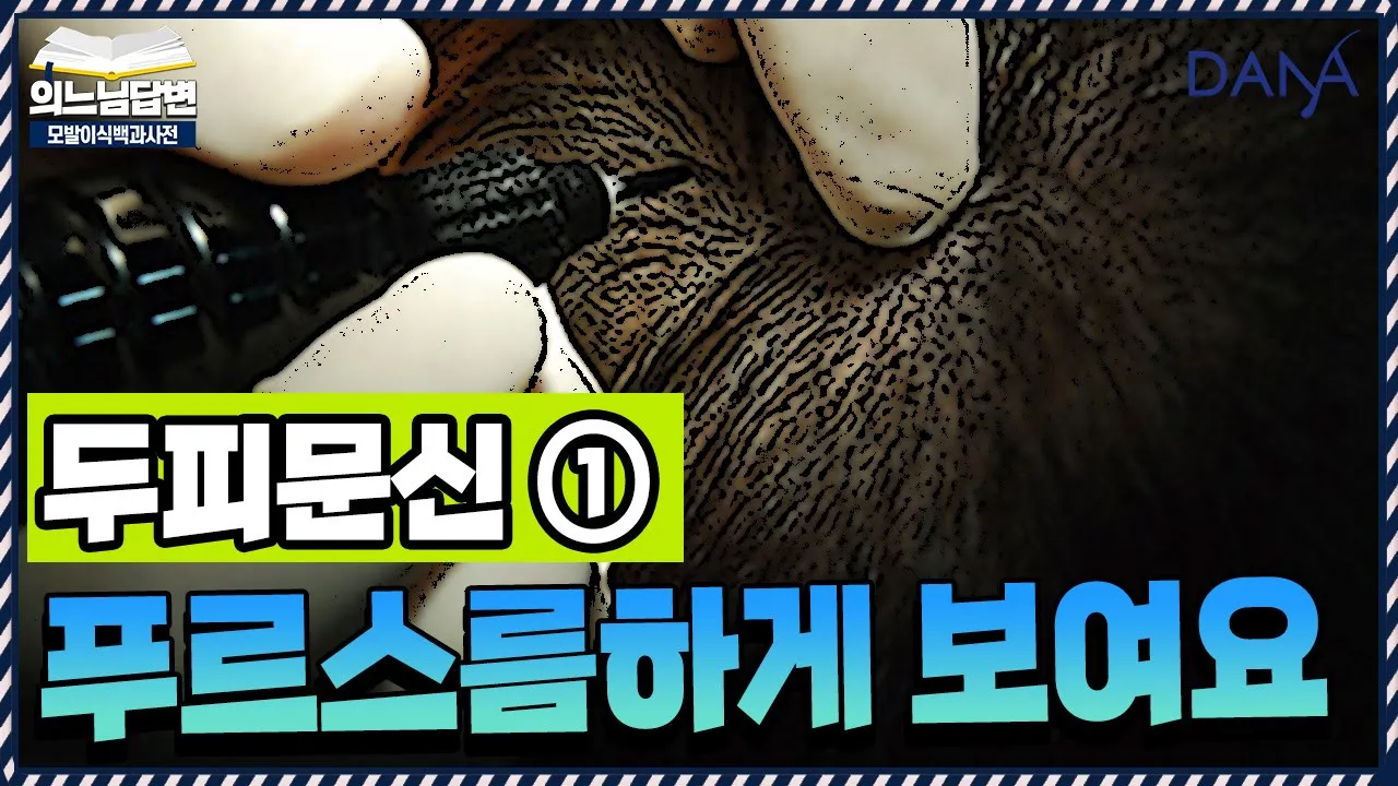 의느님답변📂시간이 지나면, 왜 파랗게 보일까?ㅣ두피문신 후 푸르스름하게 보여요①ㅣ다나성형외과(DANA)ㅣ모발이식ㅣ헤어라인교정ㅣ두피문신ㅣ탈모치료