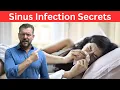 Sinus Infection Home Remedy Doctor Secrets