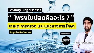 โพรงในปอดที่เกิดจากมะเร็งมีลักษณะเฉพาะอย่างไร และมีอาการร่วมใดบ้าง