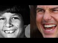 Solving the Mystery of Tom Cruise s Weird Middle Tooth