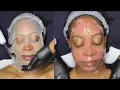 STEP-BY-STEP VIP FACIAL MICRODERM HIGH FREQUENCY