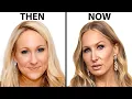 Nikki Glaser s NEW FACE Plastic Surgery Analysis