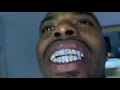 VVS Diamond Grillz In 14KT Yellow Gold White Gold