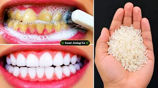 Teeth whitening at home in 3 minutes how to Naturally whiten your yellow teeth 100% effective remedy