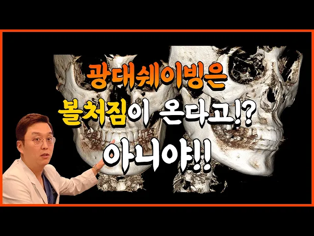 광대 쉐이빙을 하면 정말 볼처짐이 올까요?